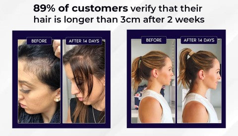 Rapid Hair Growth Revitalizing Serum