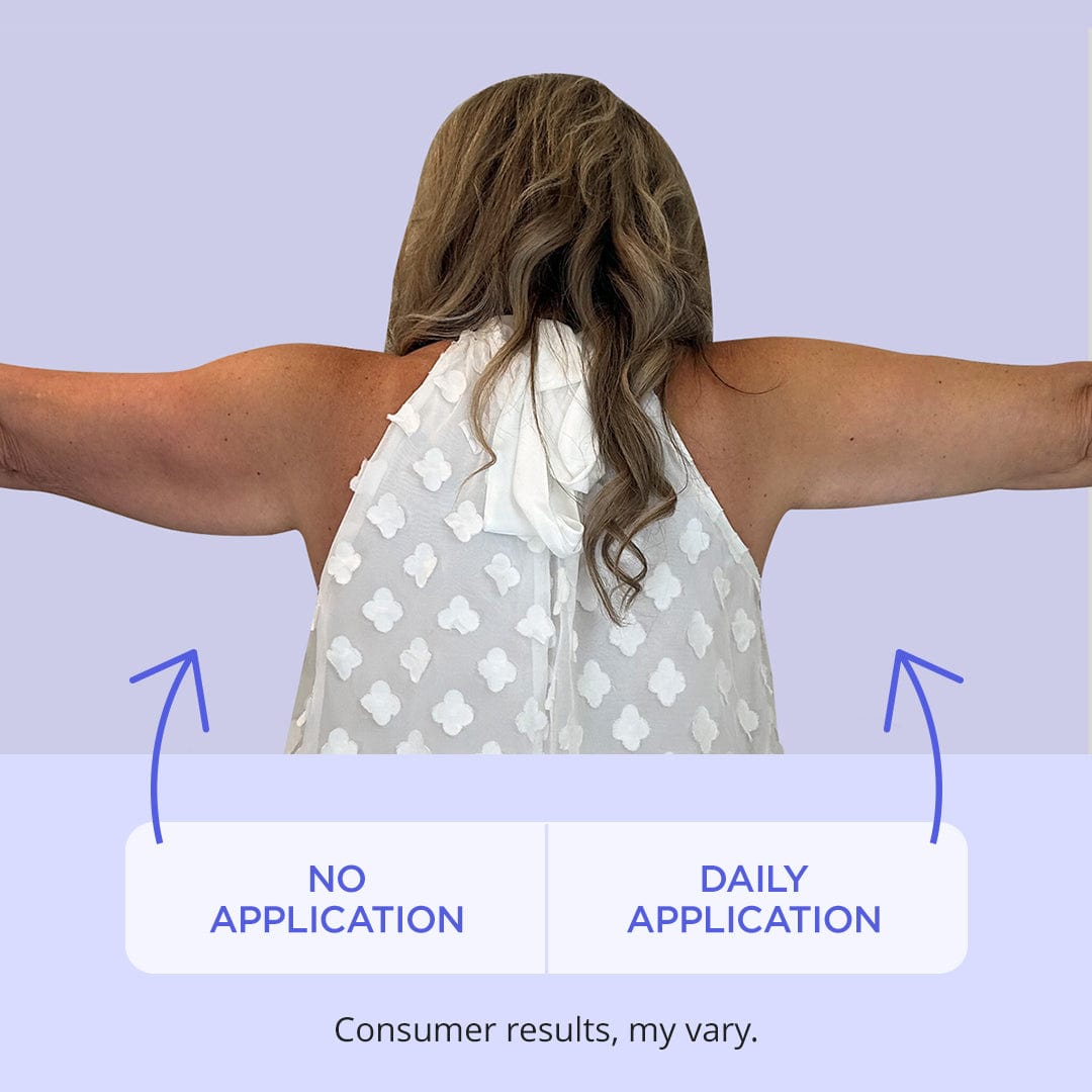 ProTight Hydration Arm Firming
