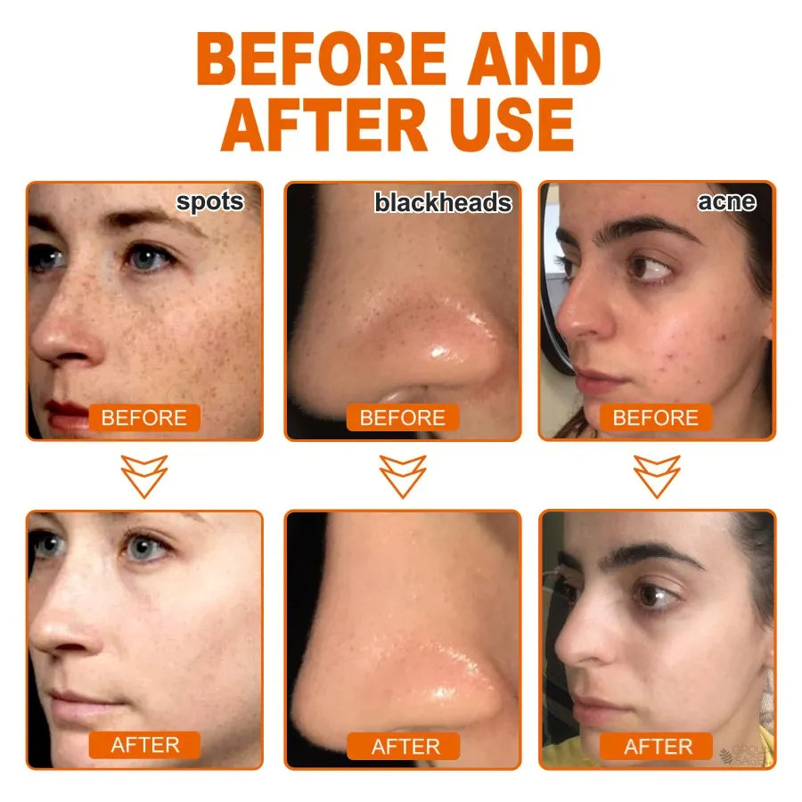 Spotless Glow Whitening Peel Mask