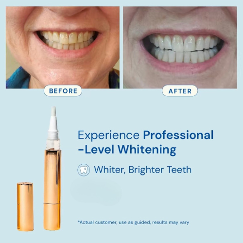 Instant Confident Smile Pen