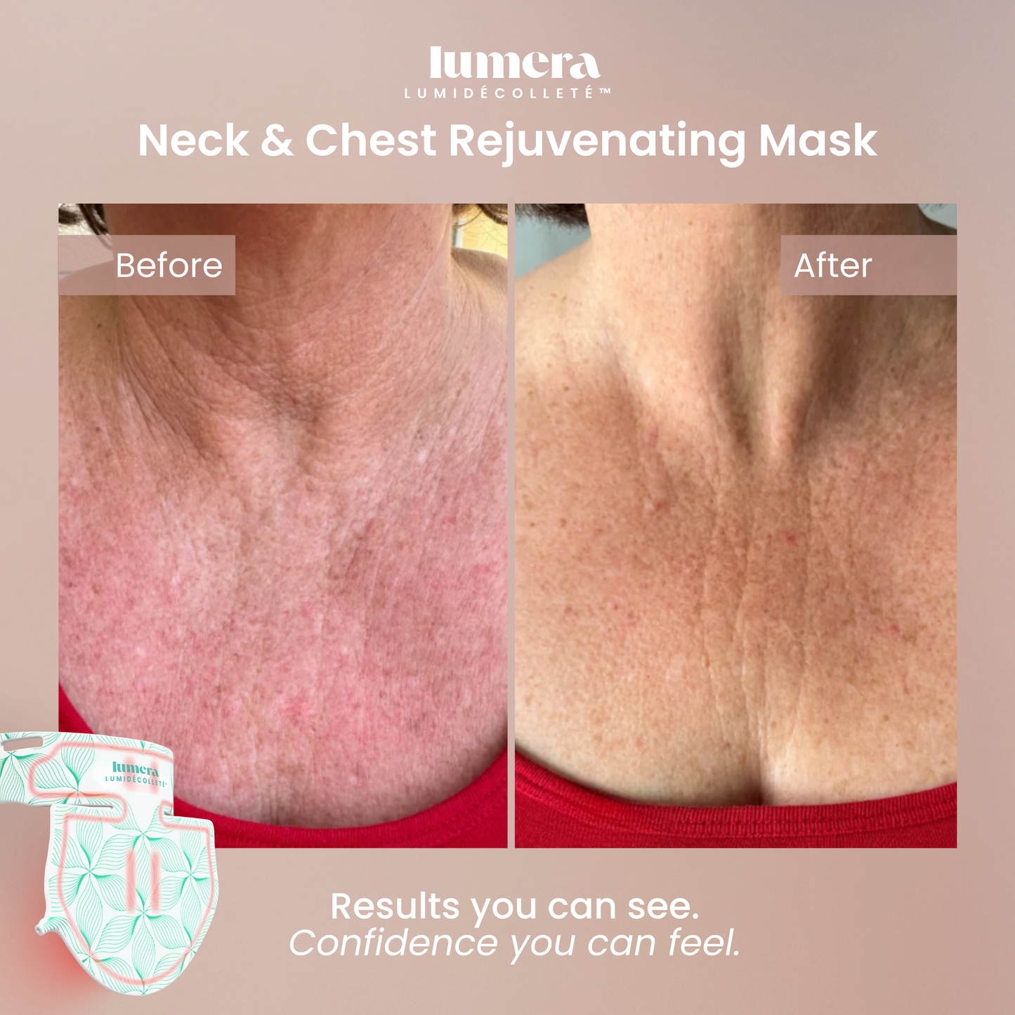 LumiDécolleté™ Therapy Mask