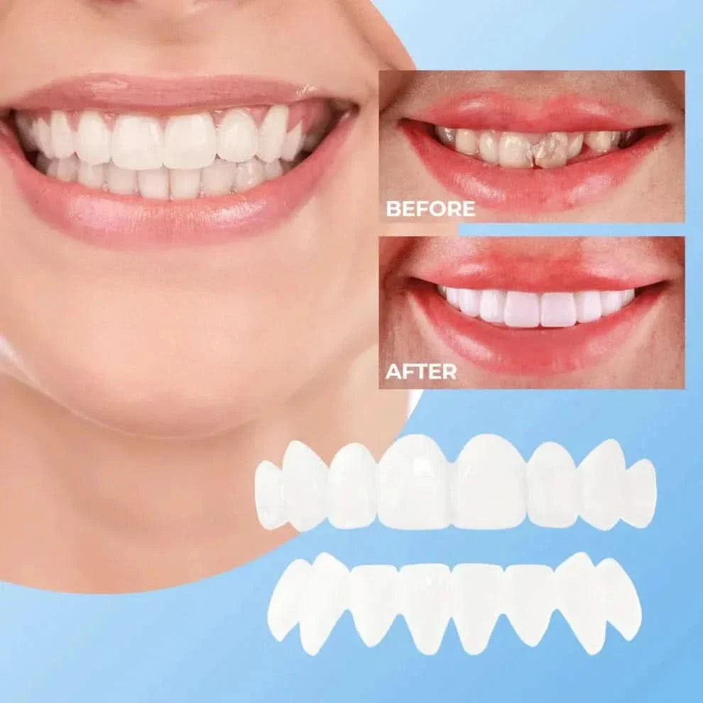 Instant Smile Confidence Boost