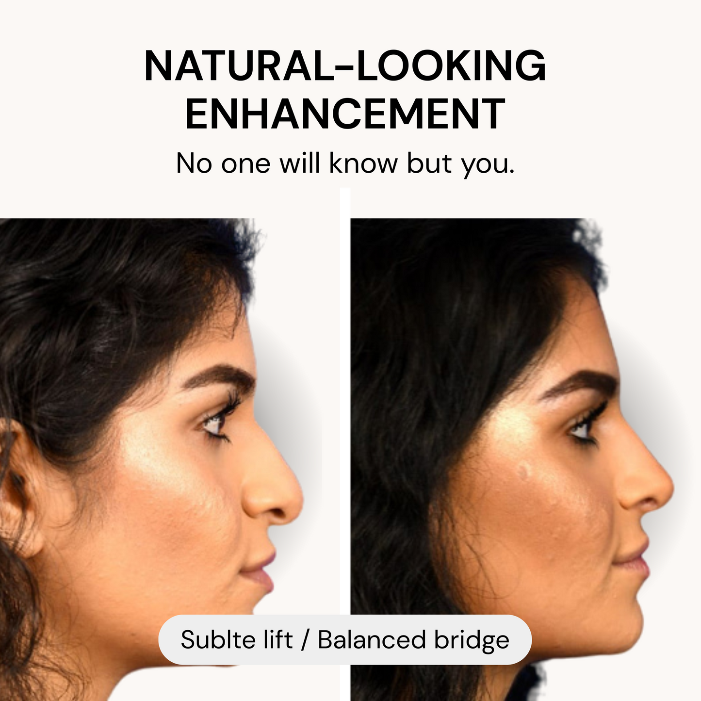 Instant Invisible Nose Lift
