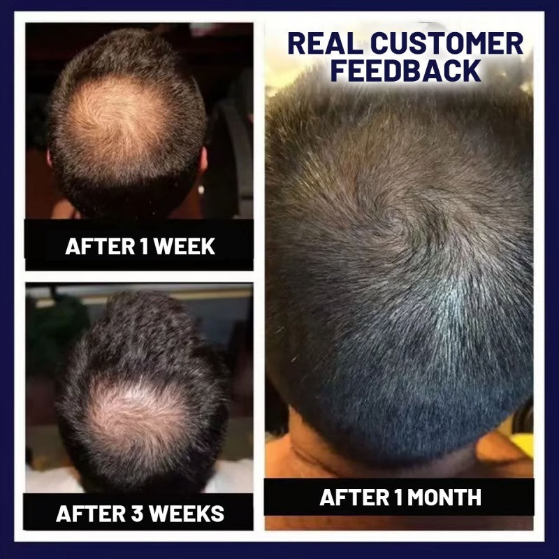 Rapid Hair Growth Revitalizing Serum