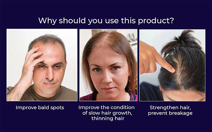Rapid Hair Growth Revitalizing Serum