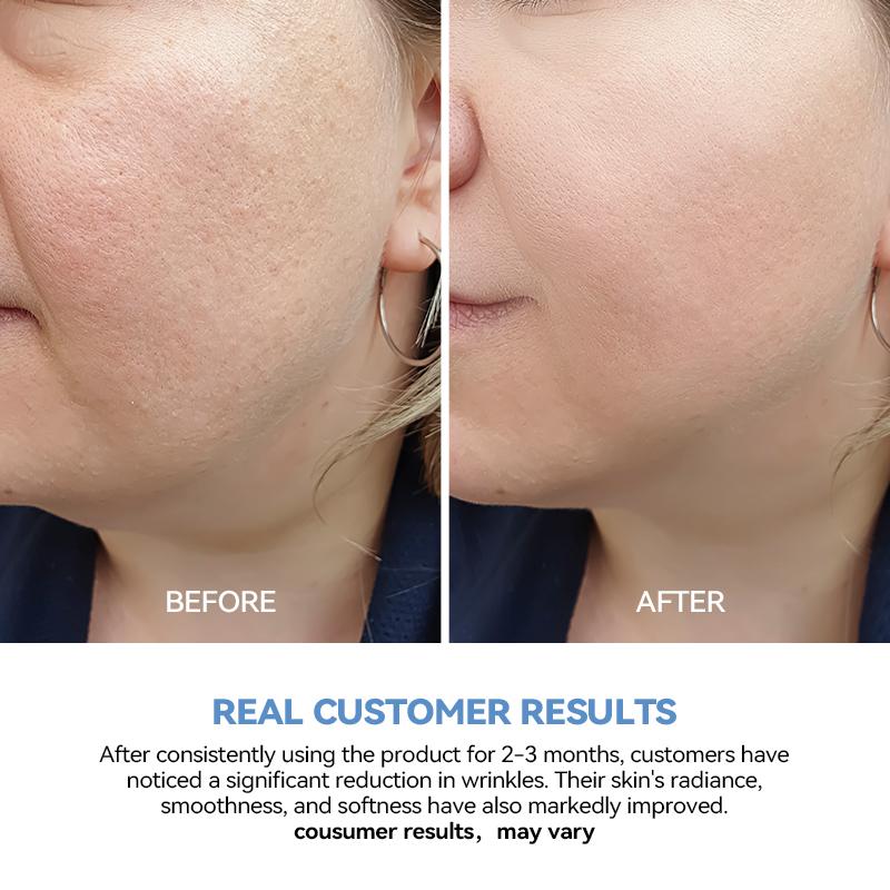 Hydration Boost Serum for Radiant Skin