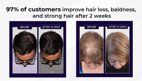 Rapid Hair Growth Revitalizing Serum