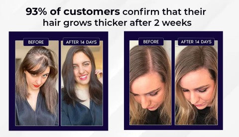 Rapid Hair Growth Revitalizing Serum