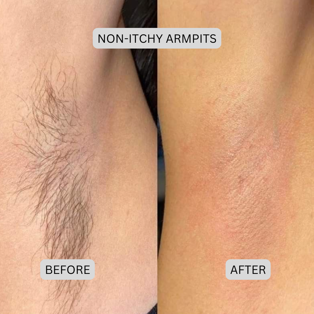 Painless Precision Dual-Head Trimmer