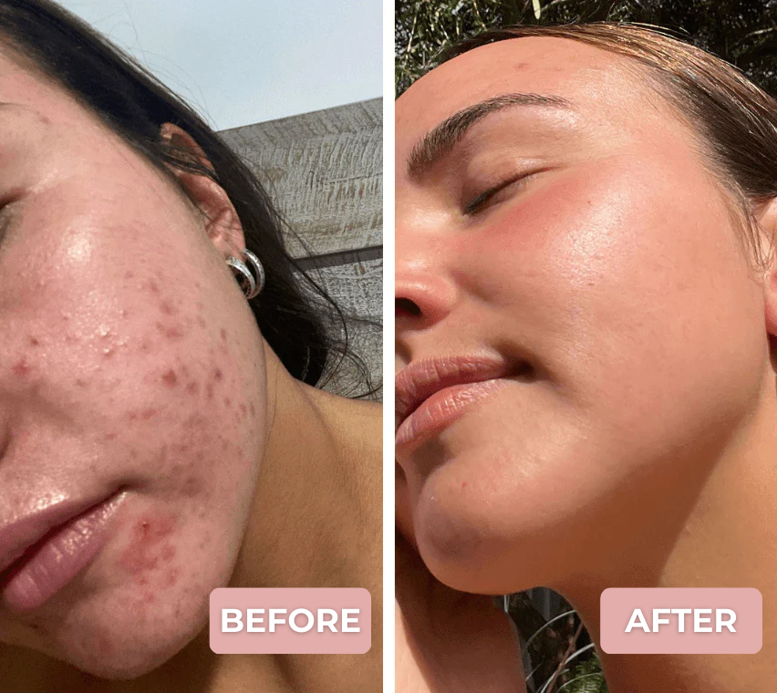 Clear & Radiant Skin Mask