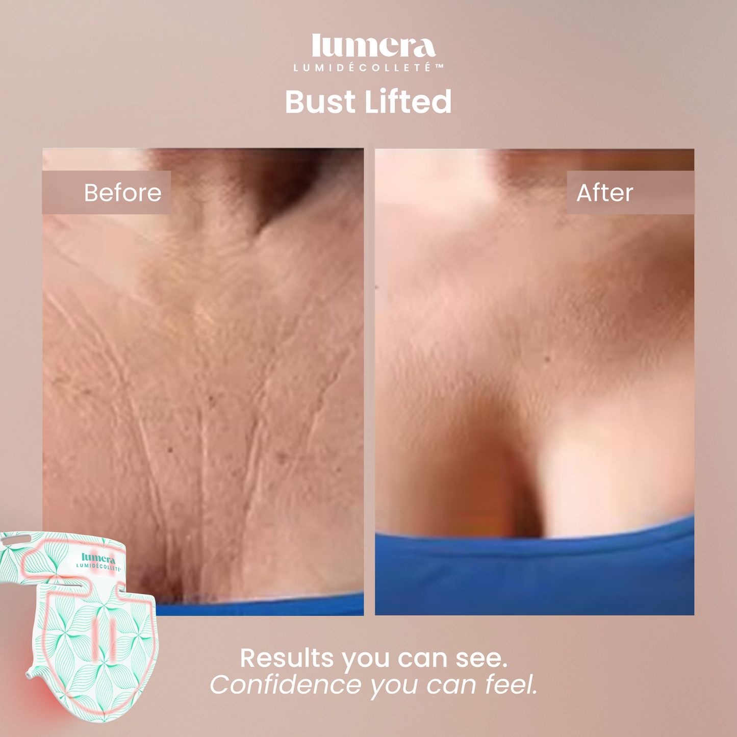 LumiDécolleté™ Therapy Mask