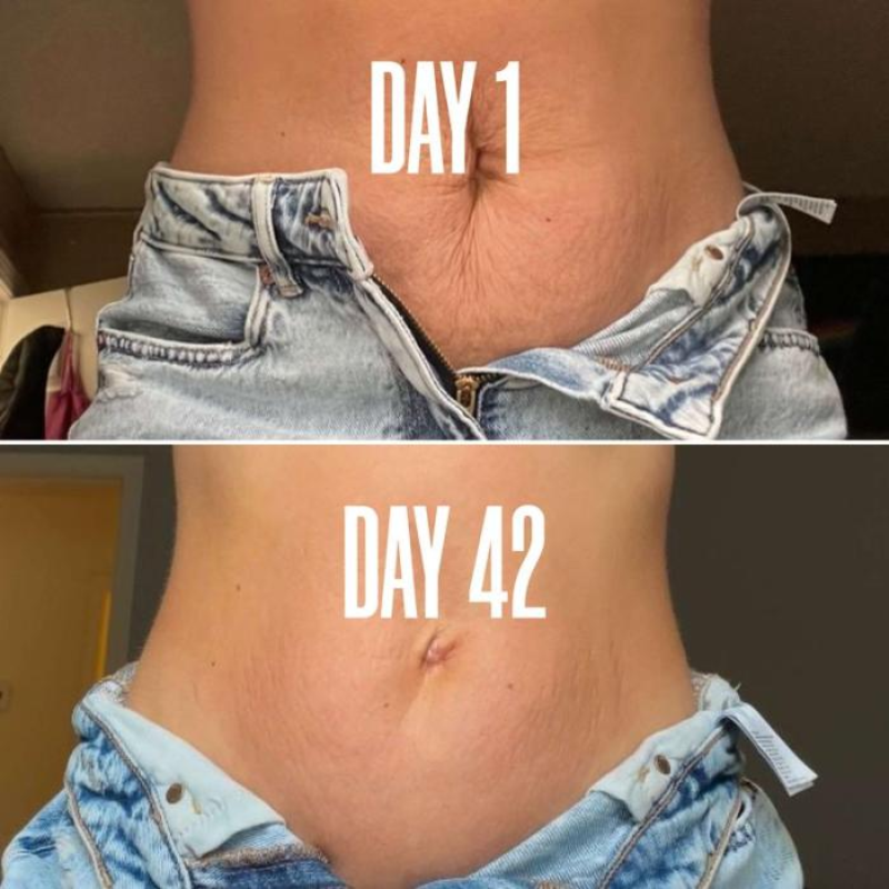 Smooth Confidence Stretch Mark Cream