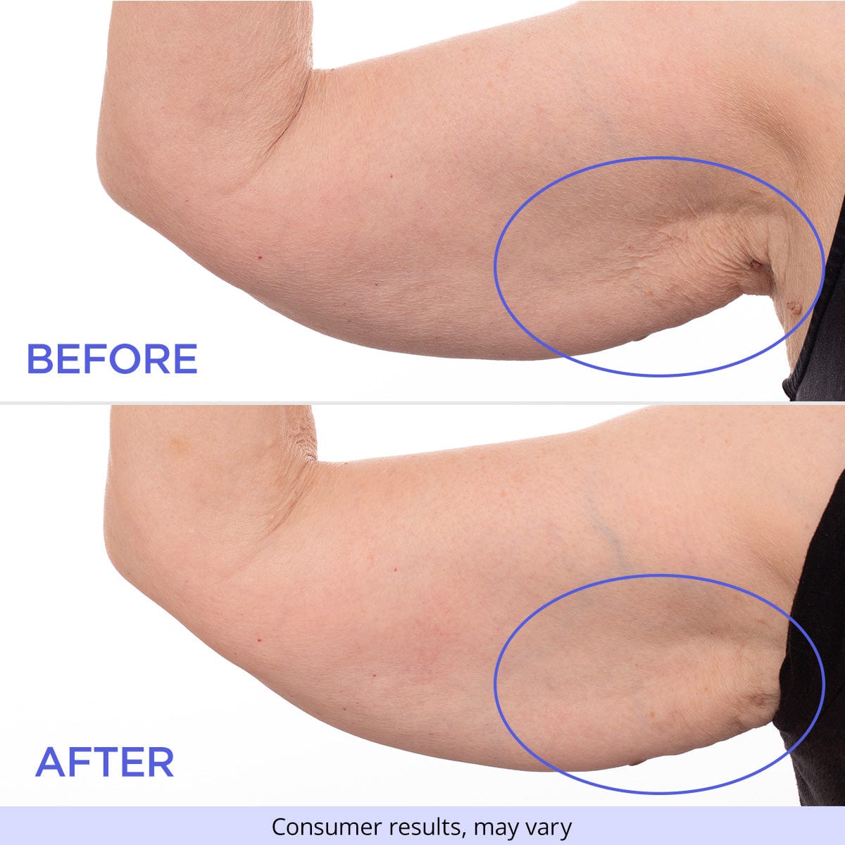 ProTight Hydration Arm Firming
