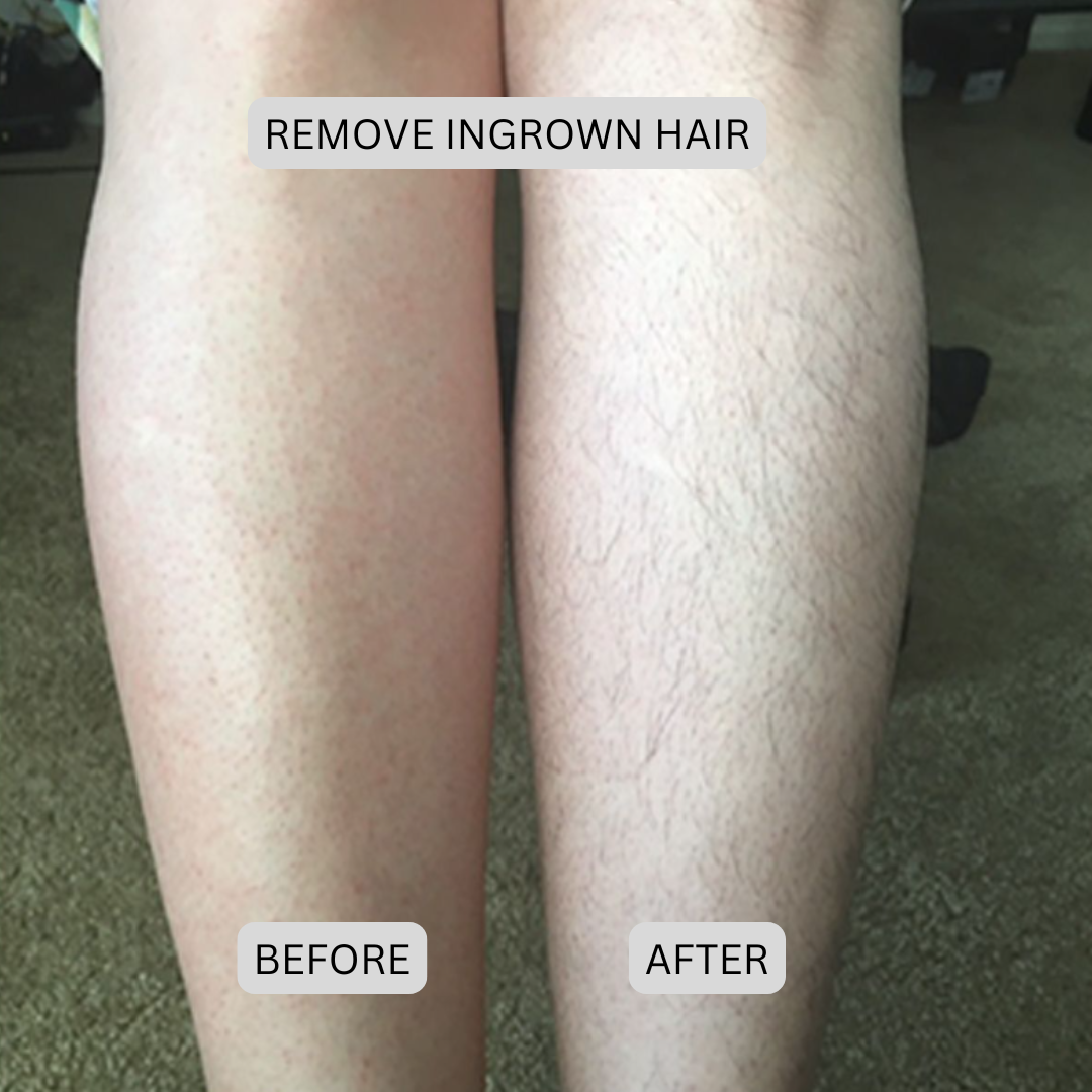 Painless Precision Dual-Head Trimmer