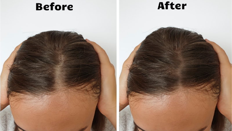 Youthful Glow Red Light Therapy