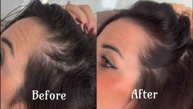 Youthful Glow Red Light Therapy