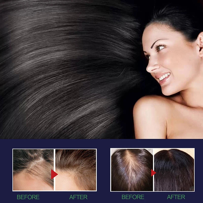 Rapid Hair Growth Revitalizing Serum