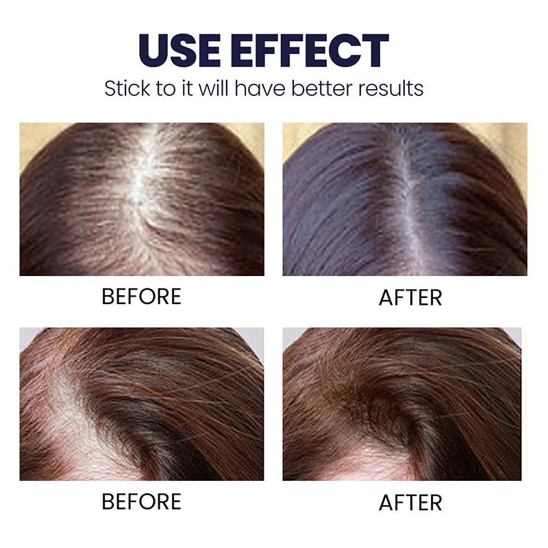 Rapid Hair Growth Revitalizing Serum