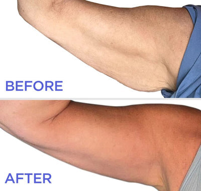 ProTight Hydration Arm Firming