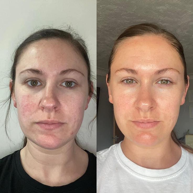 Lift & Firm Neck Rejuvenator