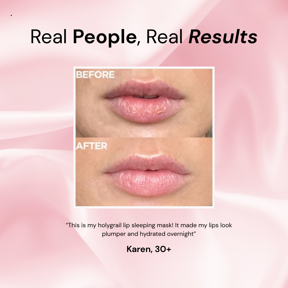 Intensely Hydrating Overnight Lip Mask