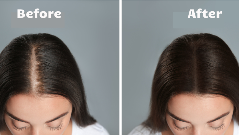 Youthful Glow Red Light Therapy