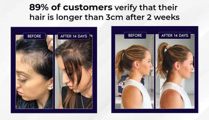 Rapid Hair Growth Revitalizing Serum