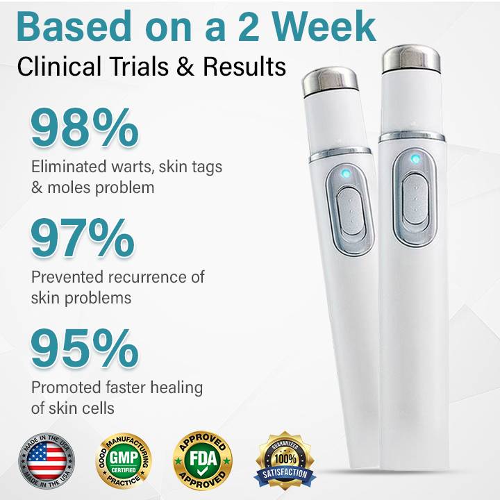 Painless Laser Mole Remover
