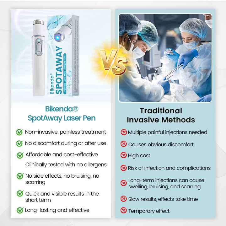 Painless Laser Mole Remover