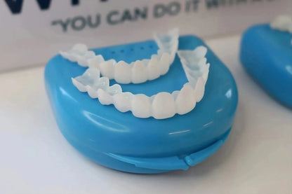 Instant Smile Confidence Boost