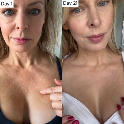 6. Visible Firmness Can Appear in 2–4 Weeks