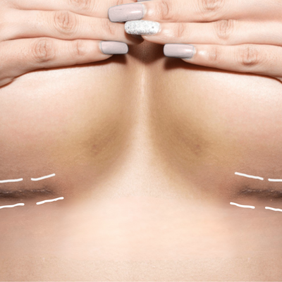 3. Surgery Works — But At a Cost