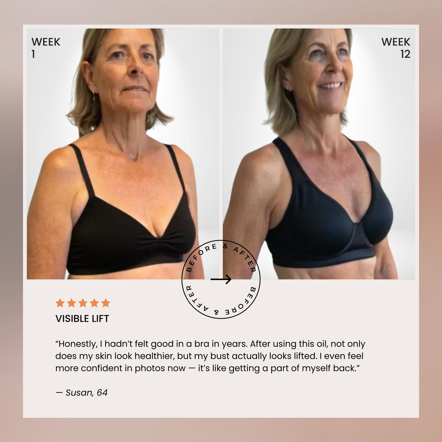 Lumera’s Bust Lift Oil 2026