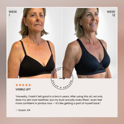 Lumera’s Bust Lift Oil 2026