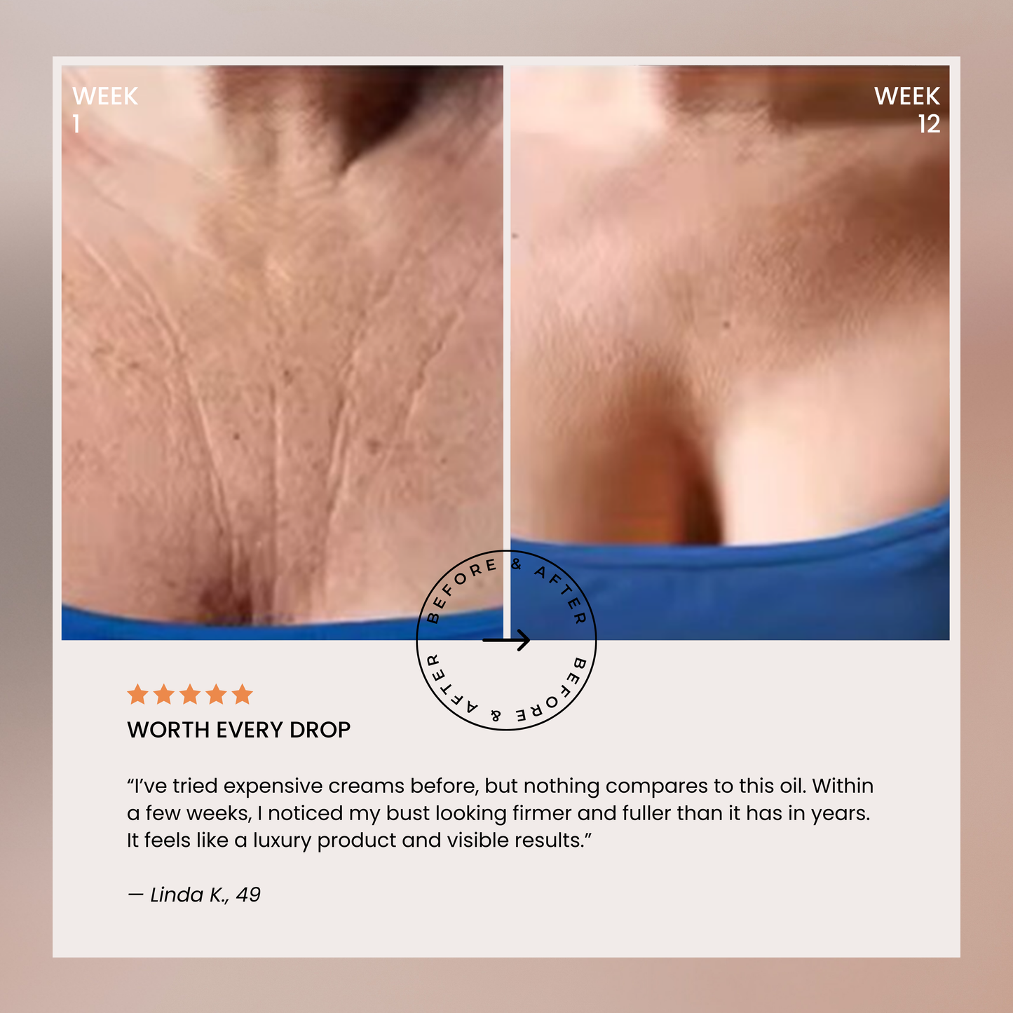 Lumera’s Bust Lift Oil 2026