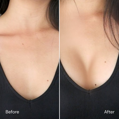 4. A Quiet “Natural Lift” Movement Is Growing