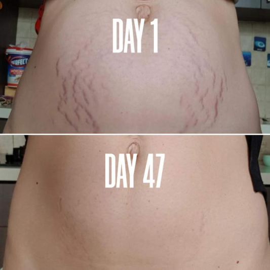 Smooth Confidence Stretch Mark Cream
