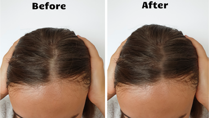Youthful Glow Red Light Therapy