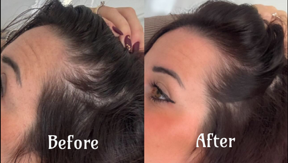 Youthful Glow Red Light Therapy