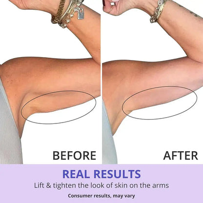 ProTight Hydration Arm Firming