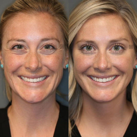 Youth Glow Wrinkle Eliminator